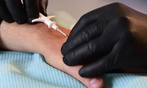 Bác sĩ tự cấy chip dưới da để “cuộc sống đơn giản hơn”