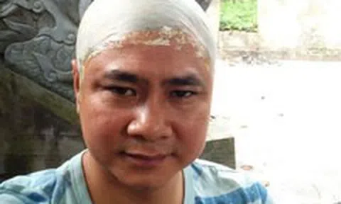 NSND Tự Long đăng hình ảnh 'xuống tóc'