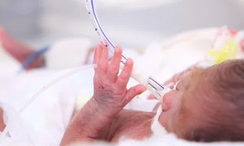 Cứu sống bé sơ sinh cực non ở Phú Thọ chỉ nặng chưa đầy nửa cân