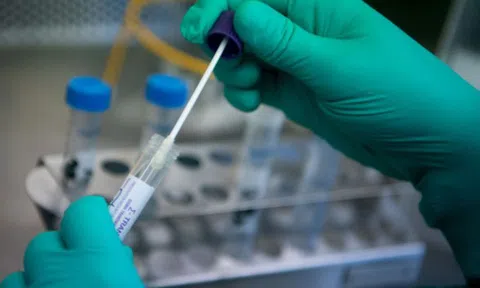 UBND TP HCM vừa có văn bản gửi Sở Y tế liên quan đến các loại kit test