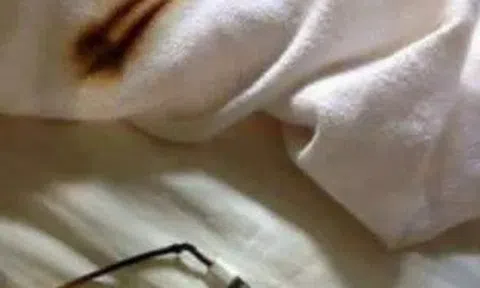 Bức ảnh cho thấy tác hại đáng sợ của việc sạc điện thoại trên giường