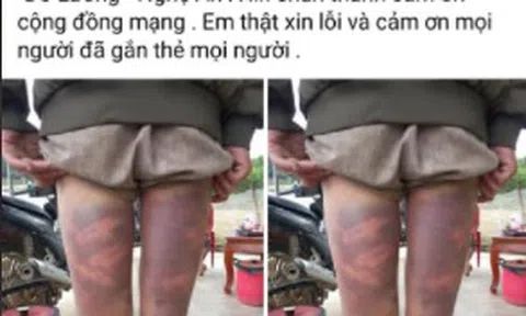Xôn xao thông tin người đàn ông bị hành hung khi được đưa về trụ sở UBND xã