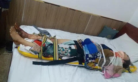 TP.HCM: Thang máy khách sạn rơi từ tầng 4 xuống hầm, cô gái chấn thương nặng