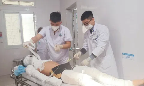 Nghi đốt pháo hoa ngày ông Công ông Táo, học sinh lớp 11 bỏng nặng