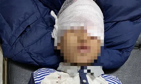 4 em nhỏ bị thương nặng nghi do tự chế pháo nổ