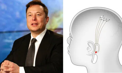 Cộng đồng so sánh việc cấy chip vào não người của Elon Musk như ‘ác mộng’ phim viễn tưởng