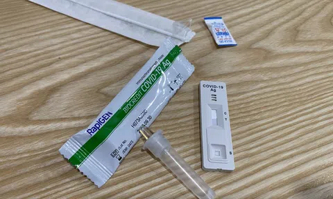 Công ty nhập khẩu hơn 3.400 tỉ đồng kit xét nghiệm Covid-19 lên tiếng