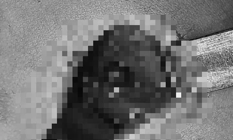 Anh trai 5 tuổi nghịch súng tự chế của bố, bắn trúng ngực em 4 tuổi