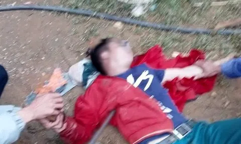 Rơi từ mái nhà xuống, người đàn ông bị thanh sắt nhổ đinh cầm tay đâm xuyên ngực