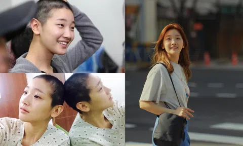 Những mỹ nhân Hàn dám 'xuống tóc' vì vai diễn