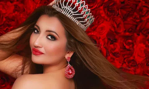Shree Saini: Cô gái biến dạng mặt vì bỏng trở thành á hậu Miss World