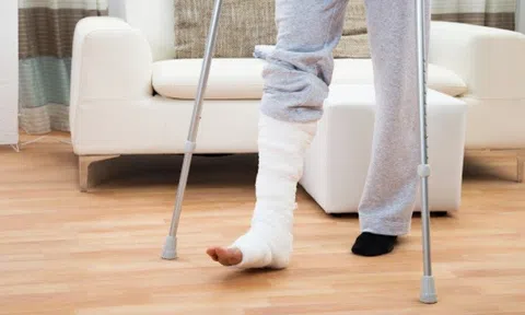 Nam thanh niên bị đánh ghen gãy chân khi đứng nói chuyện với vợ người khác