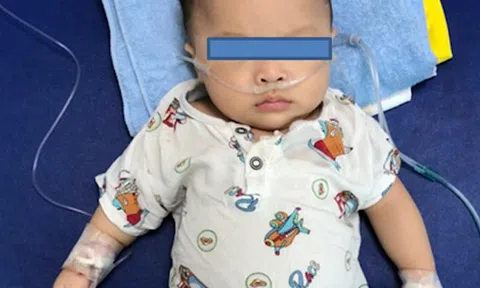 Vì nhiễm COVID-19, bệnh nhi mắc bệnh hiếm gặp của thế giới