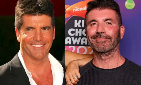 Simon Cowell ngưng tiêm botox, filler vì gương mặt trở nên 'kỳ dị'