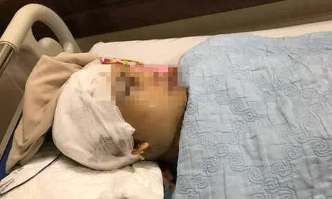 Tạm giữ 2 đối tượng đánh Phó Chủ tịch xã vỡ hộp sọ ở Hải Dương