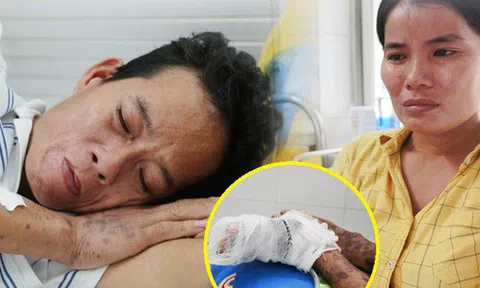 Đường cùng của người cha bị ung thư, hoại tử chân sống thoi thóp trong bệnh viện