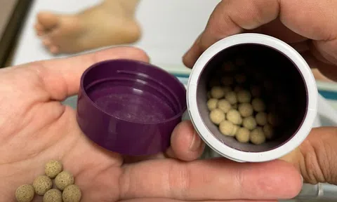 Cụ bà mệt lả, thở nhanh sau 3 tháng uống thuốc có chất cấm từ năm 1978