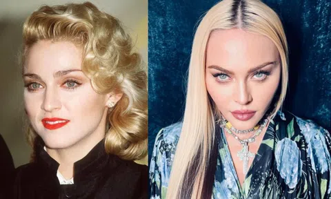 Nhan sắc ‘nữ hoàng nhạc pop’ Madonna biến đổi ra sao qua hơn 40 năm?