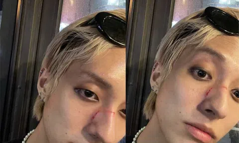 Ca sĩ Hàn bị hành hung vì là người đồng tính