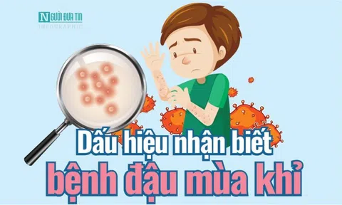 Info: Dấu hiệu nhận biết bệnh đậu mùa khỉ