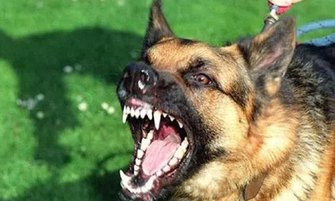 Đi chơi cùng mẹ, bé 3 tuổi bất ngờ bị chó cắn liên tiếp vào đầu và mặt