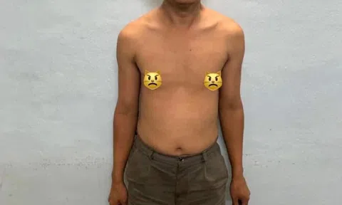 Bắt giữ kẻ chuyên rình mò, ăn cắp đồ lót phụ nữ và thực hiện hành vi dâm ô