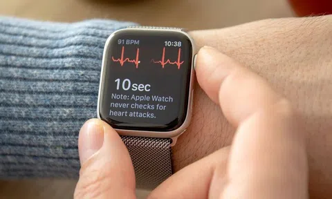 Apple Watch sẽ được sản xuất tại Việt Nam