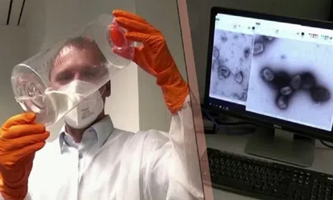 WHO nghiên cứu đột biến gen của bệnh đậu mùa khỉ