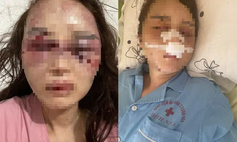 Cán bộ Quản lý thị trường đánh đập bạn gái dã man đã có vợ con