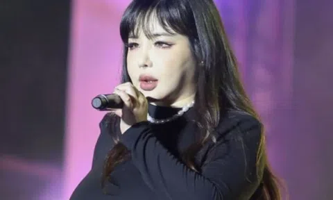 Park Bom (2NE1) khiến fan phát hoảng vì tăng cân cực độ