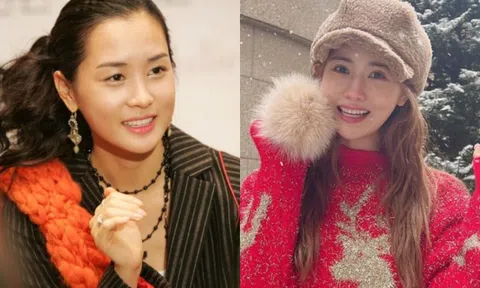 Gương mặt khác lạ của ‘mỹ nhân dao kéo’ Lee Da Hae