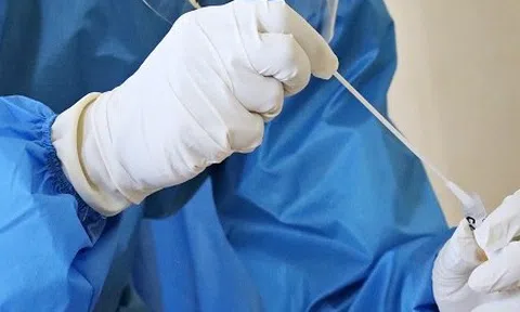 Tiếp xúc với SARS-CoV-2 có được công nhận là bệnh nghề nghiệp hưởng BHXH?