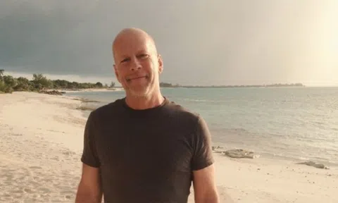 Bruce Willis mắc chứng sa sút trí tuệ