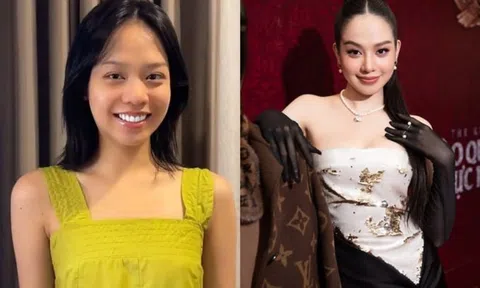 Hoa hậu Thanh Thủy nói về quyết định phẫu thuật thẩm mỹ