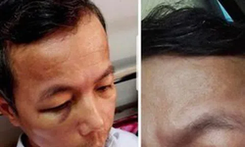 Quảng Bình: Hiệu trưởng đánh hiệu phó nhập viện