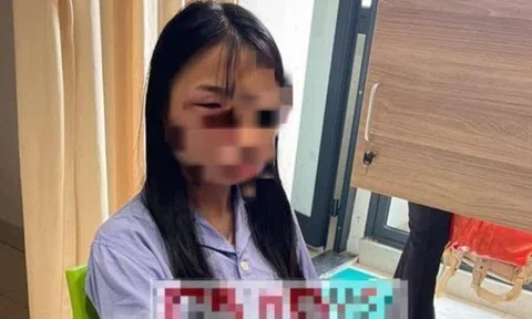 Giám định thương tích nữ sinh lớp 8 bị đánh hội đồng