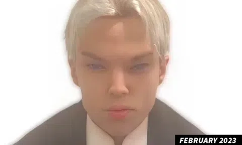 Diễn viên qua đời vì phẫu thuật để giống Jimin BTS