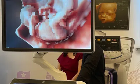 Thuốc phá thai bán thoải mái, chuyên gia đề xuất quản lý