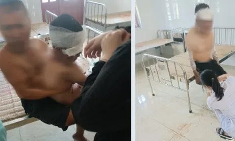 Cháy nhà, 2 người trong gia đình bị bỏng