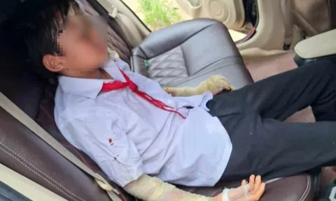 Nổ bóng bay, 7 học sinh nhập viện