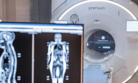 Công nghệ y khoa tương lai xuất hiện trong đời thực: Chỉ 2.500 USD có thể phát hiện ung thư lẫn 500 bệnh khác sau khi "quét" toàn thân, hàng nghìn người chờ khám, chi nhánh mở không xuể