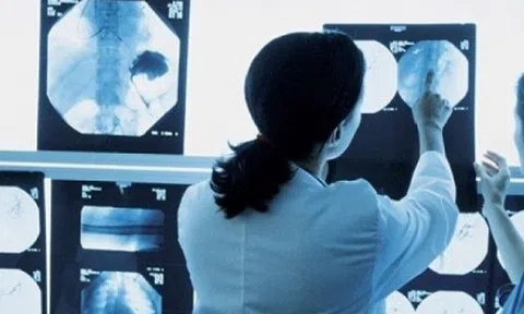 Trí tuệ nhân tạo góp phần hướng tới mục tiêu chấm dứt bệnh lao tại Việt Nam